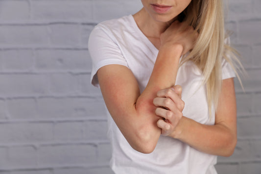 The Secret to Treating Eczema and Psoriasis with Shea Butter