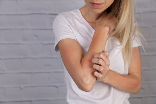 The Secret to Treating Eczema and Psoriasis with Shea Butter
